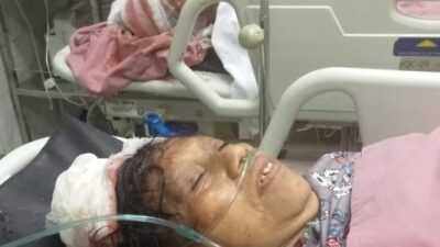 Kendala Biaya Dua Korban Pembancokan Masih Kritis Belum Dioperasi