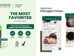 Tips Merawat Rambut Rontok dan Berketombe agar Tetap Percaya Diri Sepanjang Hari